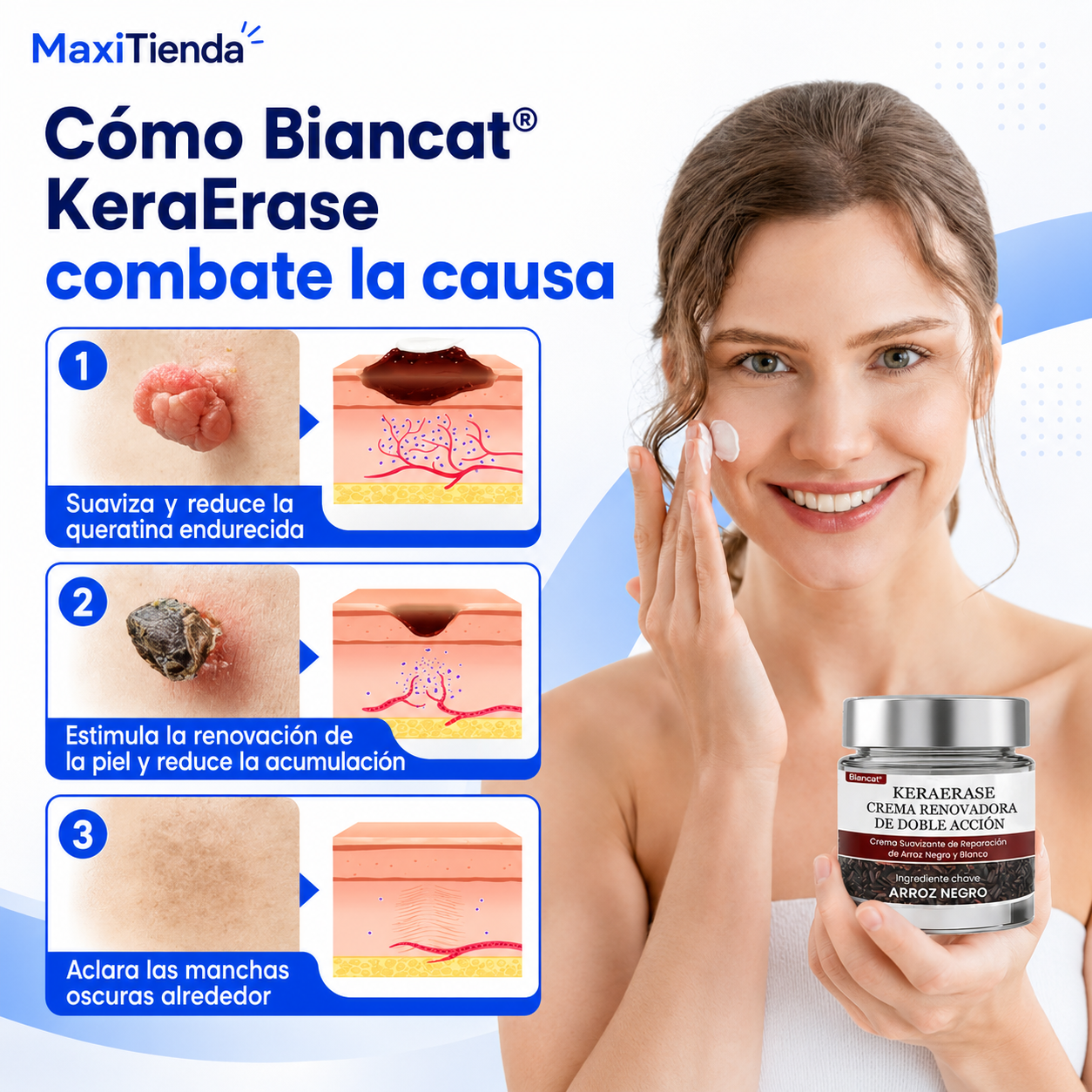 KeraErase – Crema de Cuidado Intensivo para Marcas en la Piel